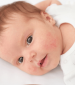 Reacțiile Adverse ale Bebelușilor la Anumite Alimente: Între Precauție și Intervenție Medicală